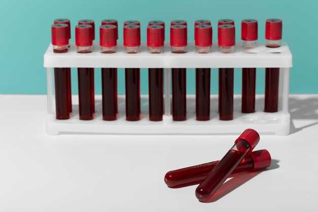 Анализ крови на тромбоз: основные показатели