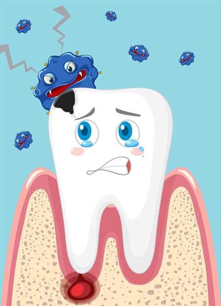 Кариес зубов: опасность и угроза для здоровья