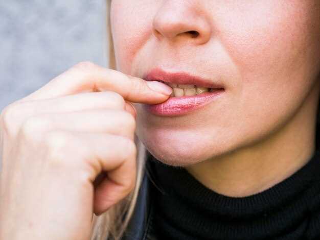 Эффективные способы избавиться от язвочек во рту