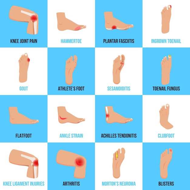 Как узнать о повреждении пальца на ноге