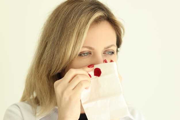 Опрокидывать голову при кровотечении из носа: важно знать