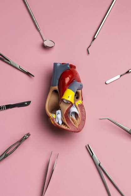 Методы лечения операцией при инфаркте