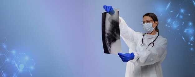 Пневмония на снимке флюорографии: особенности диагностики и описание