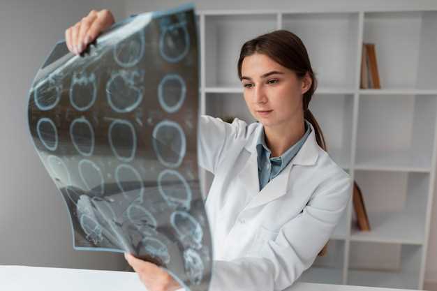 Спирально-компьютерная томография головного мозга: как проходит и для чего нужна