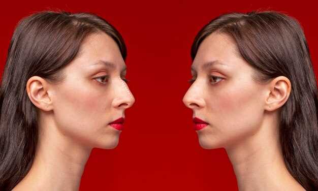 Увеличение губ: противопоказания, возможные осложнения, фото до и после [Пластическая хирургия Здоровье]