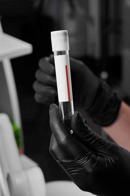 Мочевая кислота в крови: как измеряется?